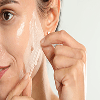 Skin Peels