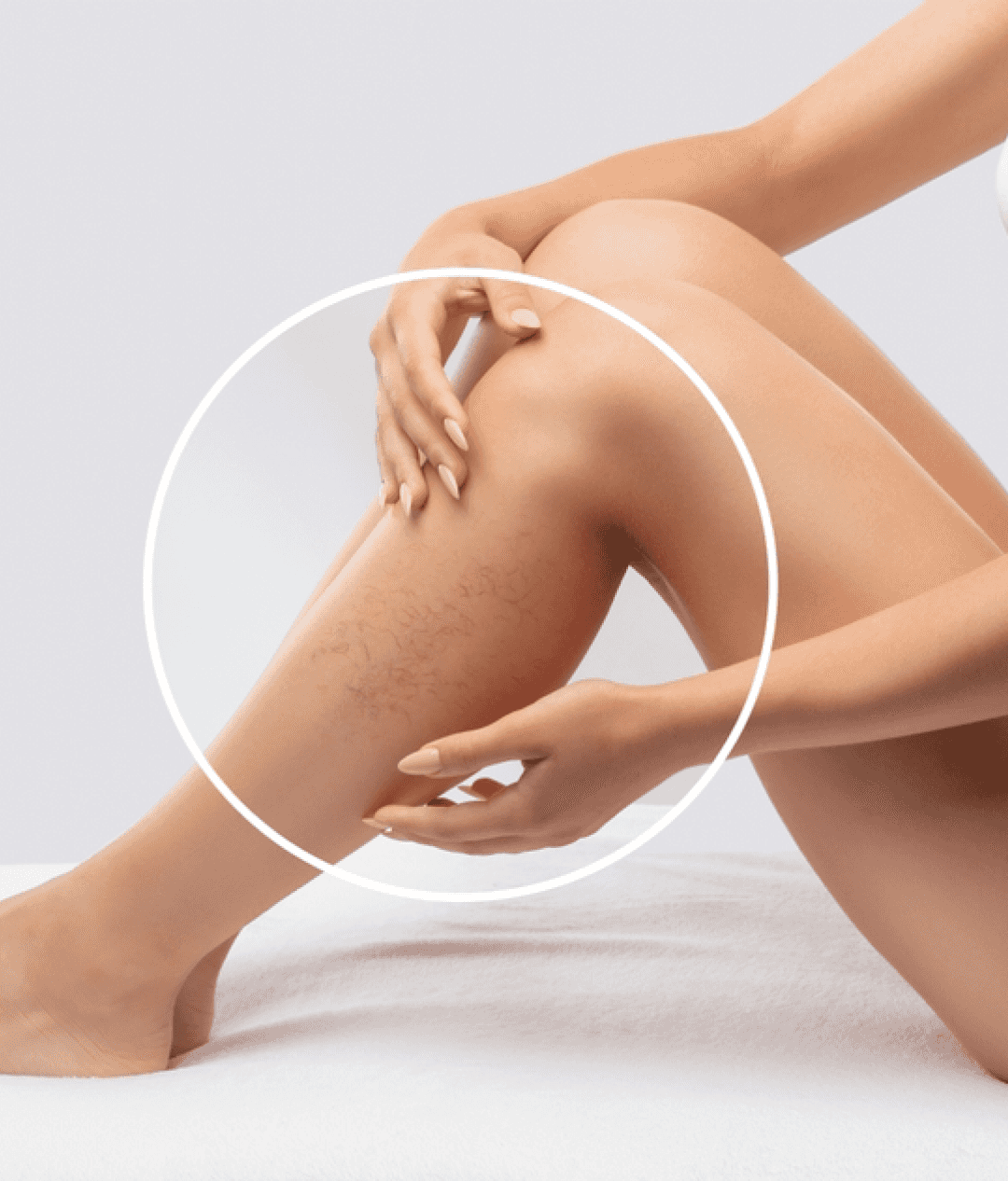 Thread Vein Removal