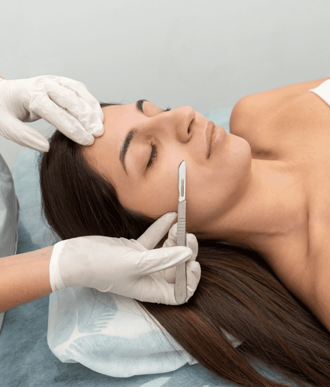 Dermaplanning Treatment